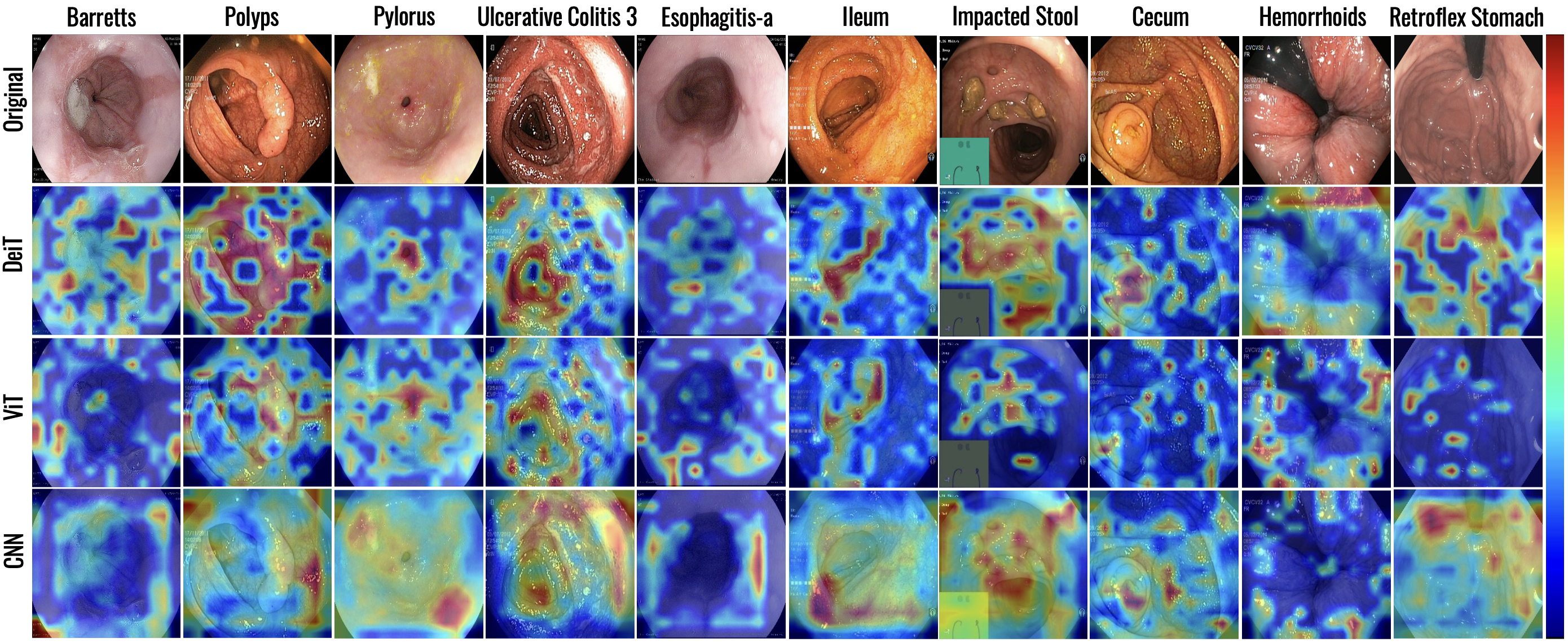 AI-Guided Anatomical Landmark and Abnormality Detection for Autonomous Endoscopy Examination
