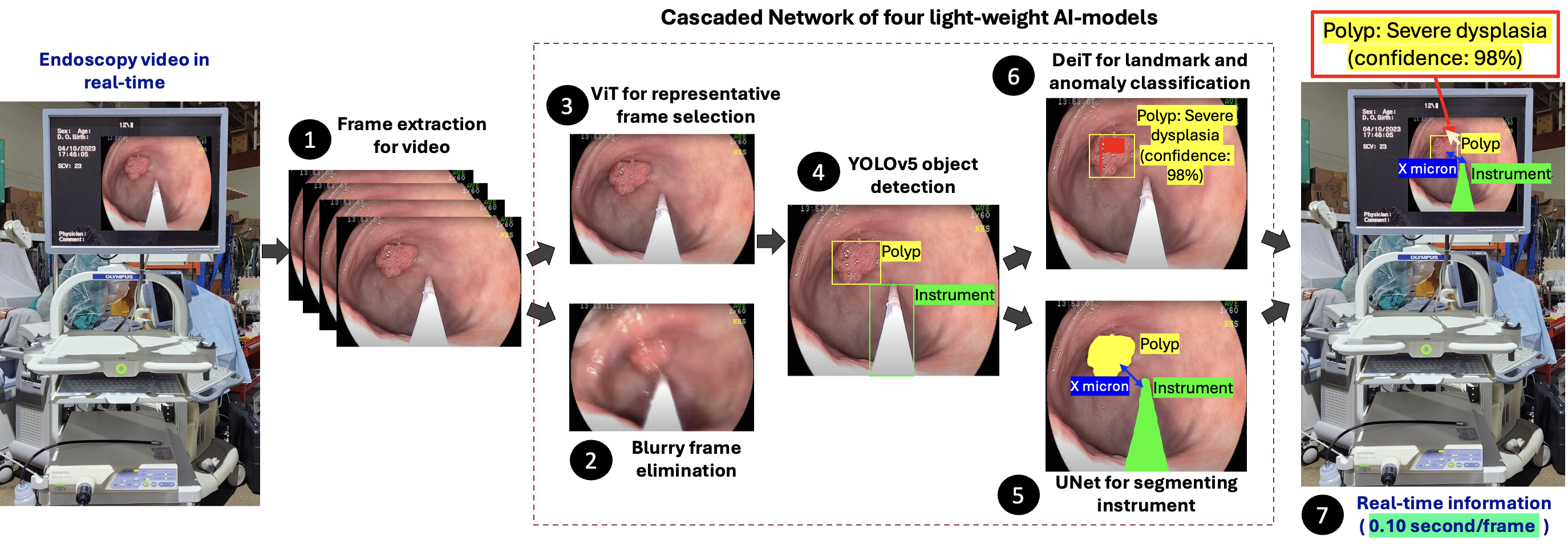 Endoscope vision enhancing ease for endoscopists and comfort for patients