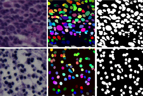Nuclei Segmentation in Histopathology Images
